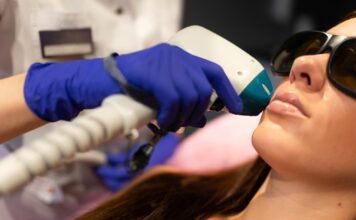 Épilation laser à Bordeaux : découvrez des résultats durables