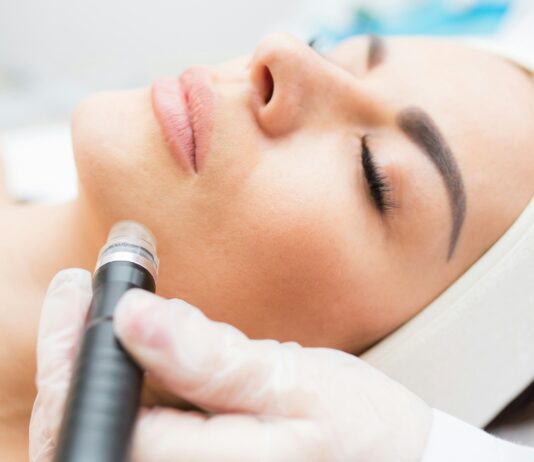 Essayez le laser épilatoire à bordeaux pour une peau lisse durable